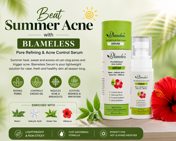 Beat Summer Acne with Blameless Pore Refining Serum ☀️